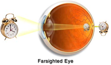 farsight